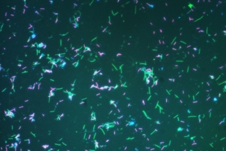 photo of pink and green bacteria