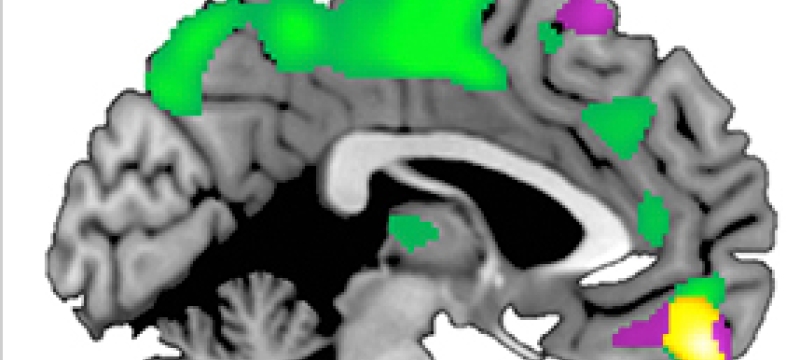 brain diagram