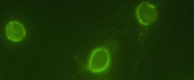 immunofluorescence image 